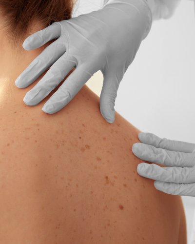 Surgical Dermatology Near Me in New York, NY Surgical Dermatology Near Me in New York, NY
