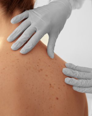 Surgical Dermatology Near Me in New York, NY Surgical Dermatology Near Me in New York, NY